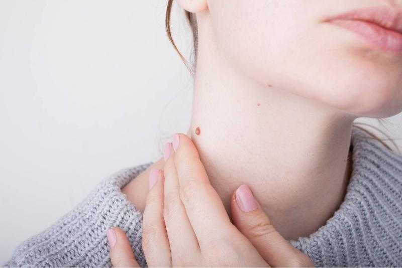 وصفة الصبار الطبيعية للتخلص من الجلد الميت فى الشتاء.. تعرفي عليها