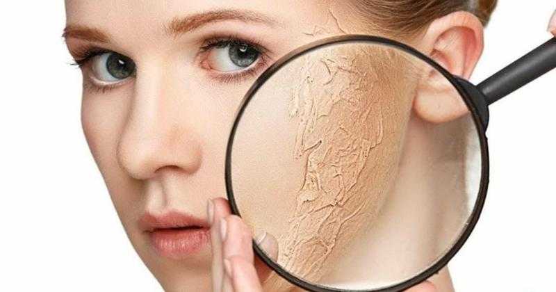 في رمضان.. وصفات سحرية بمكونات طبيعية للتخلص من الجلد الميت وتنعيم البشرة