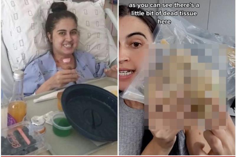 عملية زراعة القلب