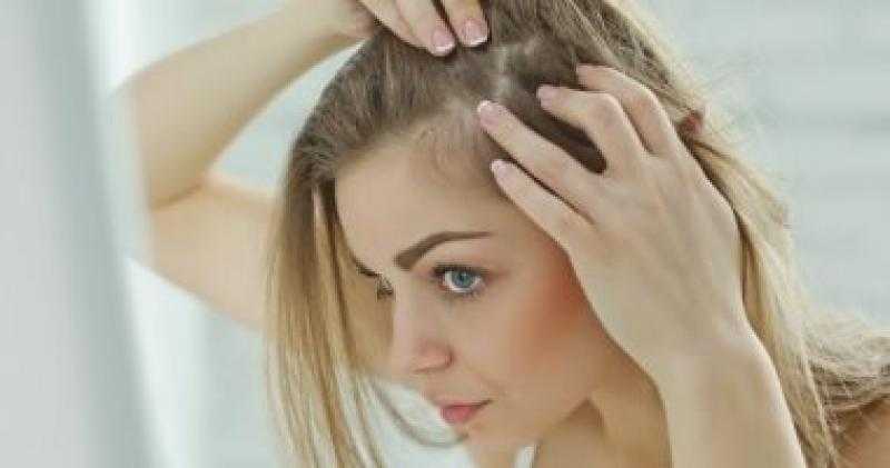 وصفة زيت الخروع السحرية لعلاج فراغات الرأس.. تعرفي عليها