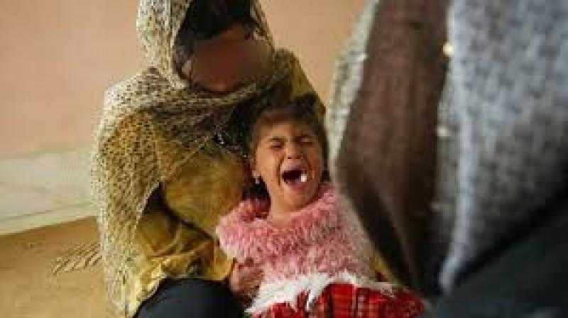 السجن المشدد 10 سنوات.. عقوبة ختان الإناث حال حدوث عاهة مستديمة للفتاة