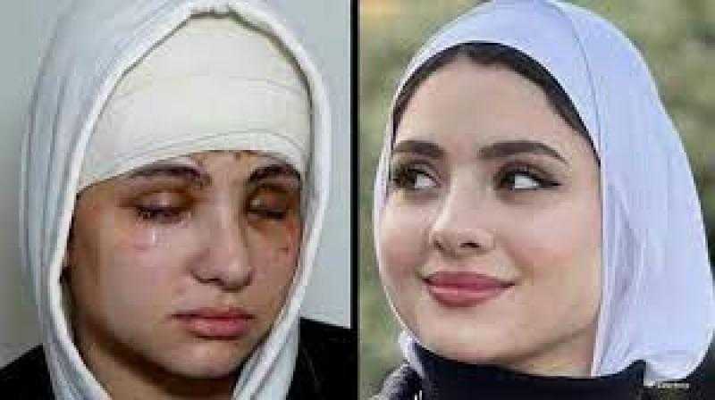 هل أودعت بدار أيتام؟ .. بلوجر مصر فقدت عينها وخرجت من بيتها
