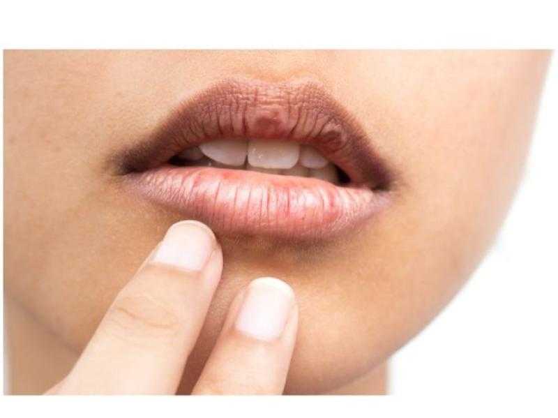 بمكونات من مطبخك.. أقنعة طبيعية لتفتيح منطقة حول الفم