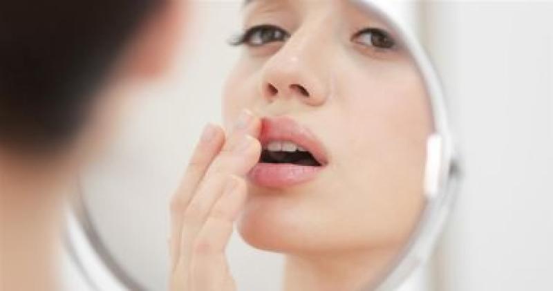 توريد الشفاه