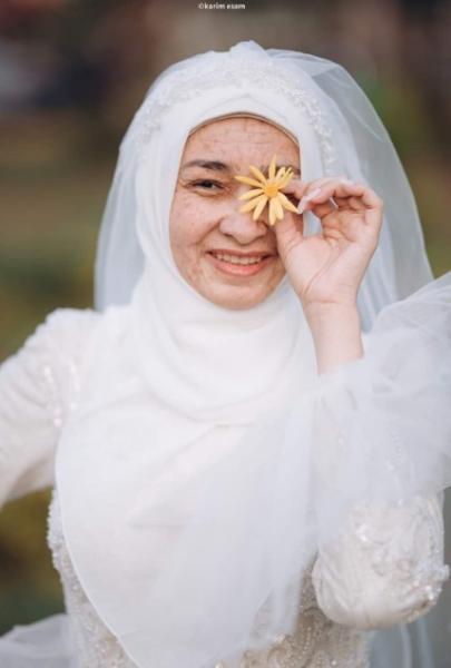 ظهرت بدون مكياج في حفل زفافها.. صور زفاف فتاة الشيخوخة تشعل السوشيال قبل رمضان