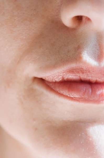  منطقة حول الفم