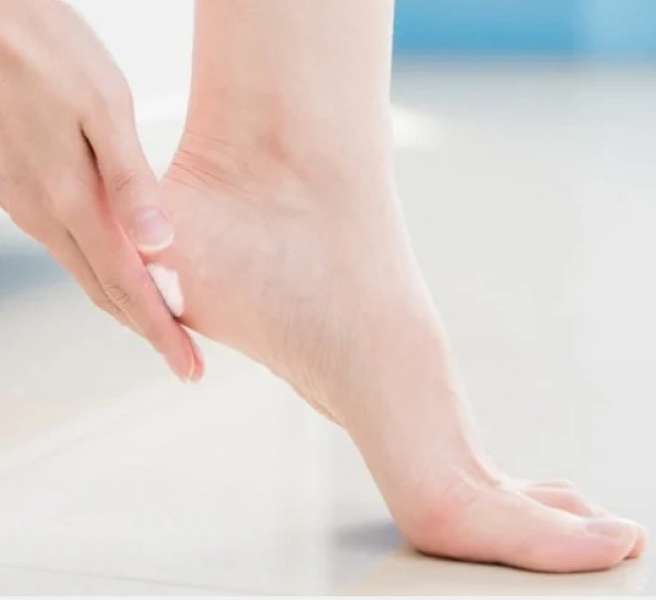 تشقق الكعبين