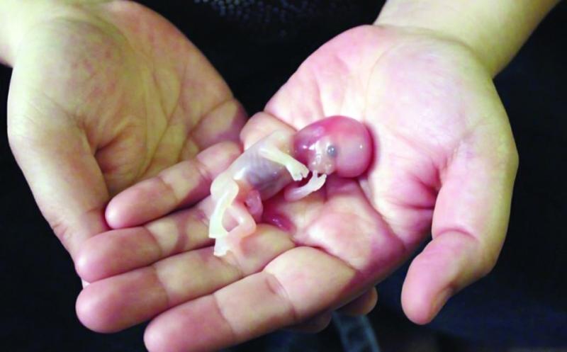 فتوى بضوابط دقيقة، مفتي الجمهورية يوضح حكم استخدام الأجنة المجهضة علميًا