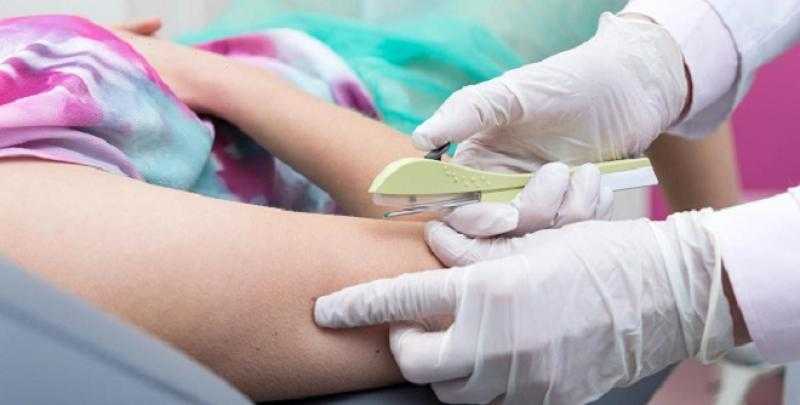 كبسولة منع الحمل.. حلاً آمنًا وفعالاً لتأجيل الإنجاب