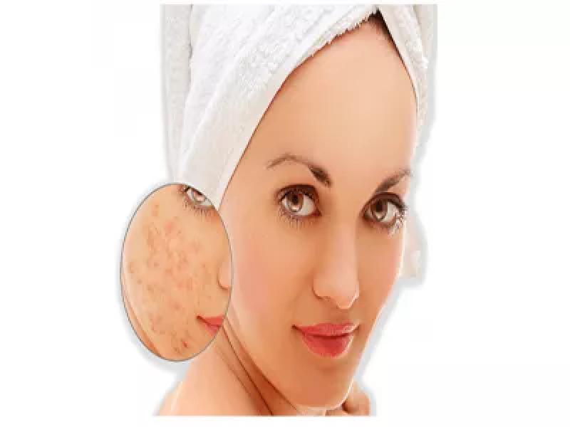 مستحضرات التجميل