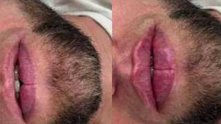 ظاهرة تجميل الشفاه بين رجال روسيا.. بين الصدمة الثقافية والتحدي الاجتماعي