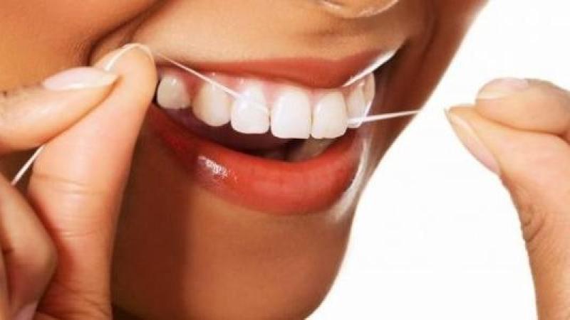 اصفرار الأسنان