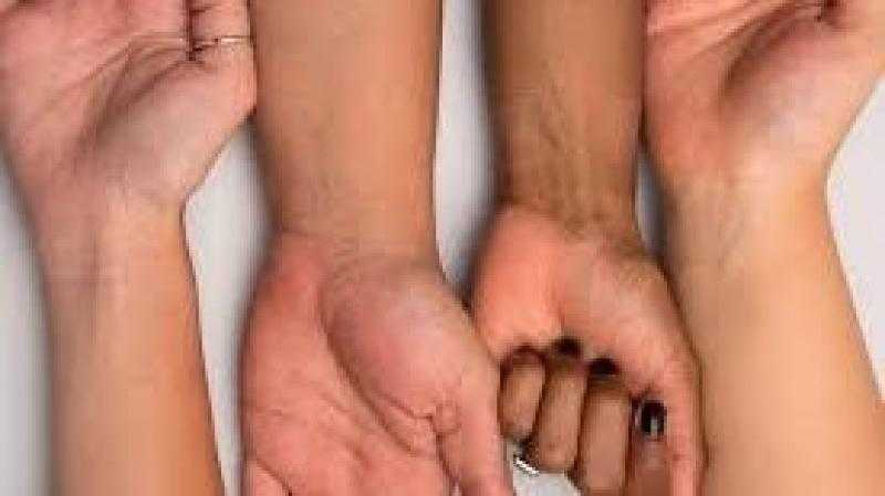 علامات اسمرار البشرة غير الطبيعي.. أسباب خفية وراء التغيرات الجلدية