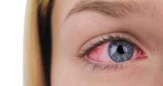 تعرف على طرق آمنة لعلاج التهابات العين منزليًا وأعراض تستوجب زيارة الطبيب