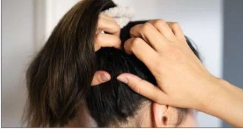 الشغعر