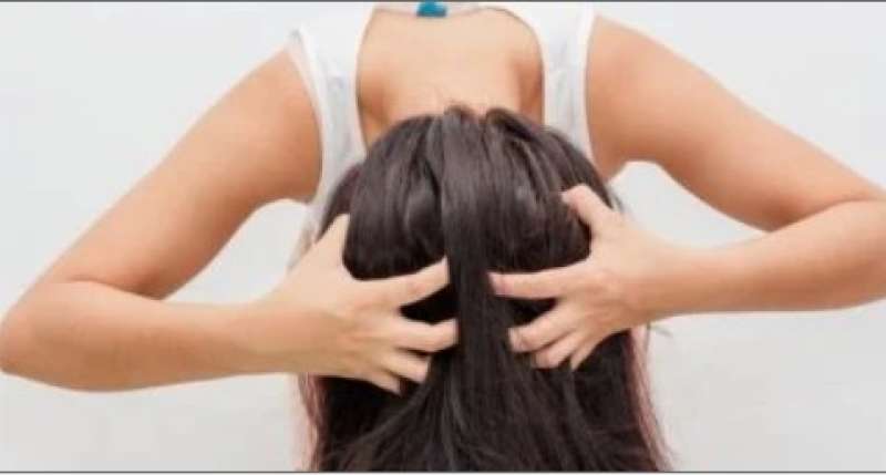 حرقة فروة الرأس