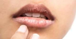 الشفاه.. نافذة للصحة العامة ومؤشرات مبكرة تكشف عن مشكلات داخلية