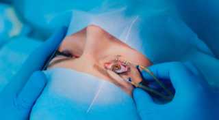 ابتكار دعامة دقيقة لعلاج المياه الزرقاء .. ثورة في الطب العيني