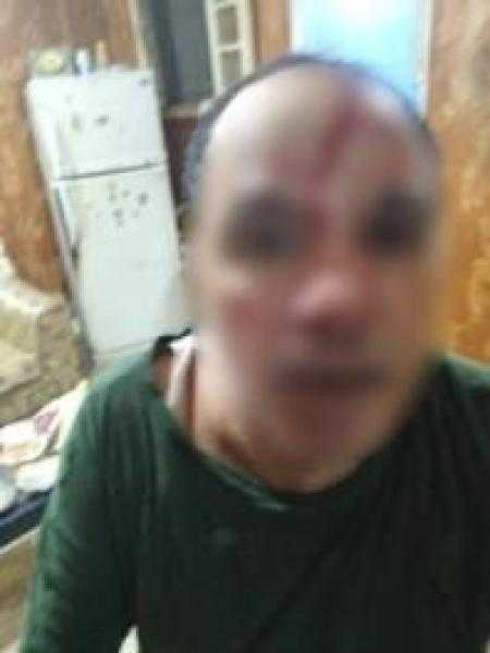 الغربية.. خلافات أسرية تدفع شخص وأولاده بالتعدى على شقيقه وابنته بسلاح أبيض