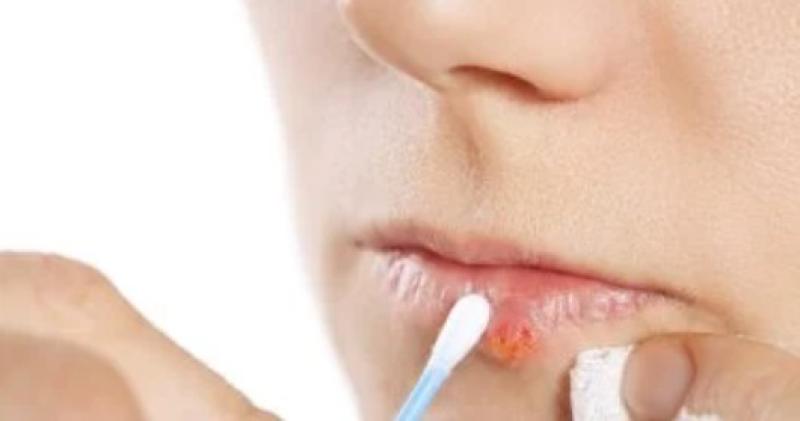 هل جسمك يرسل لك نداء استغاثة؟ اكتشف علامات نقص العناصر الغذائية وتأثيرها على صحتك