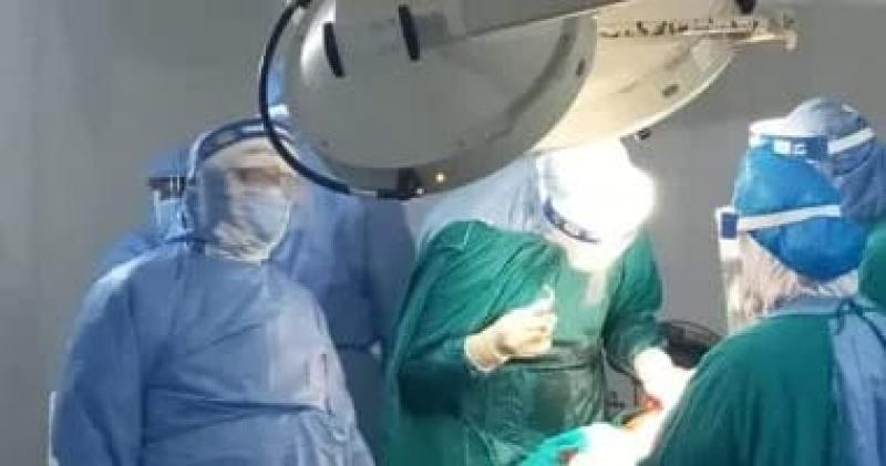 العملية