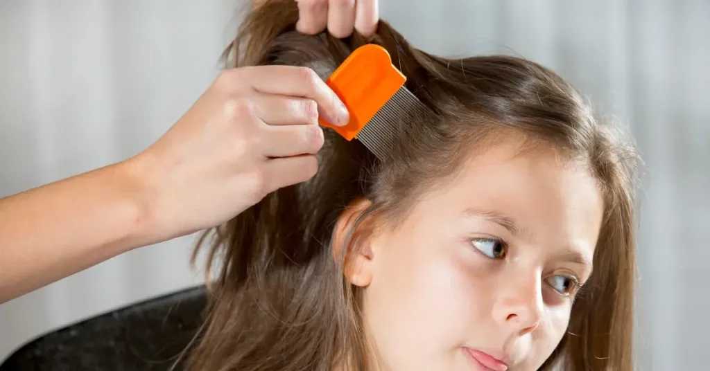 نصائح فعالة للوقاية من قمل الرأس عند الأطفال