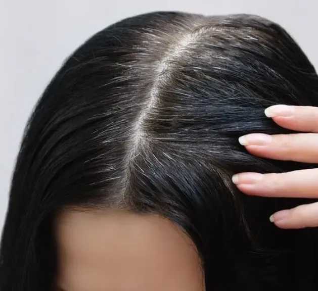 حلّ سحري للشيب المبكر.. وصفات طبيعية تعيد لشعرك لونه ولمعانه