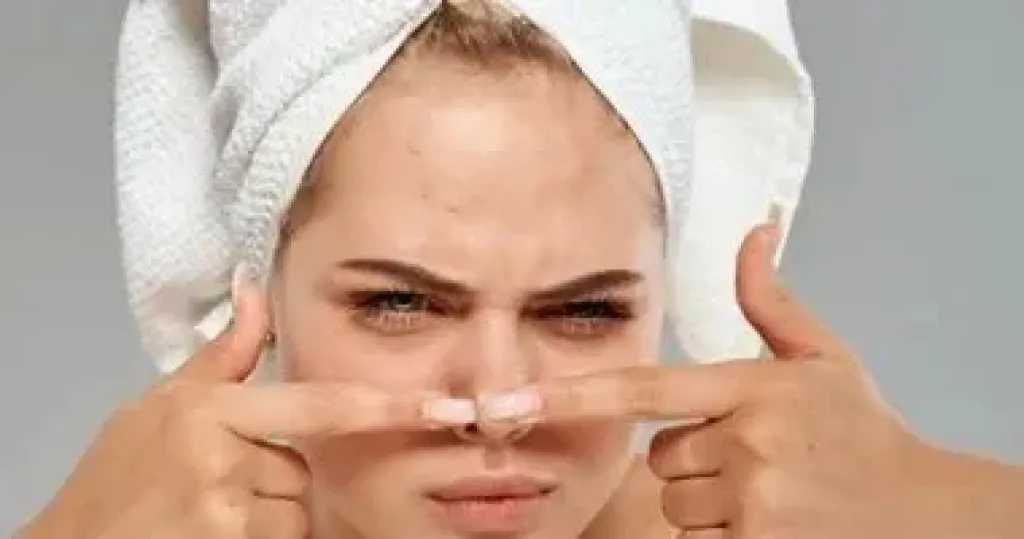 أسرار جمالك.. طرق فعّالة للتخلص من بثور الأنف والعناية ببشرتك بطريقة آمنة وطبيعية