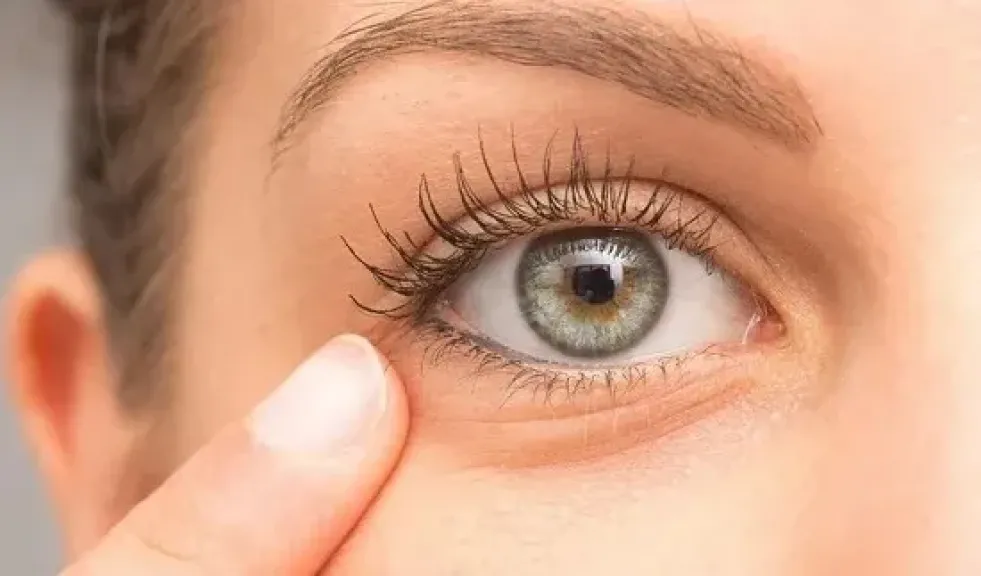 تجاعيد العين