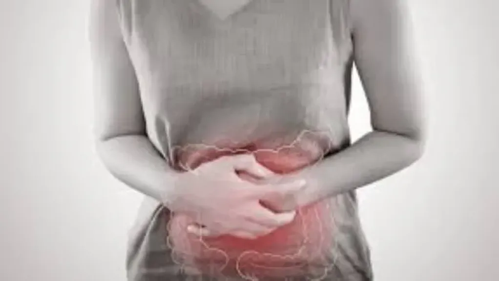 متلازمة القولون العصبي