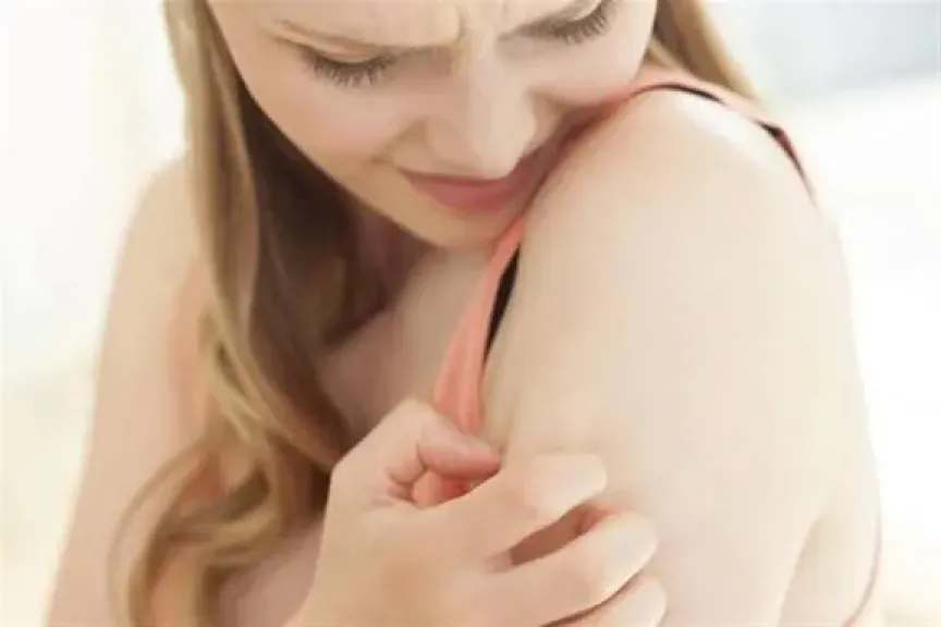 الحكة الجلدية