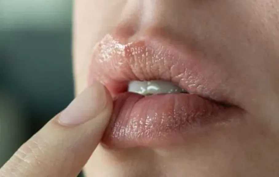 عناية شتوية.. وصفات طبيعية لعلاج تشققات الشفاه بشكل فعال