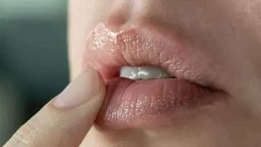 عناية شتوية.. وصفات طبيعية لعلاج تشققات الشفاه بشكل فعال