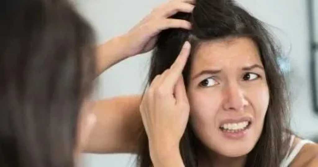 قشرة الرأس.. أسباب وعلاجات بين الشائعات والحقيقة