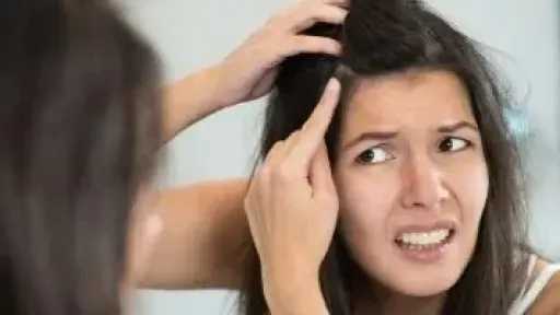 قشرة الرأس.. أسباب وعلاجات بين الشائعات والحقيقة قشرة الرأس.. أسباب وعلاجات بين الشائعات والحقيقة