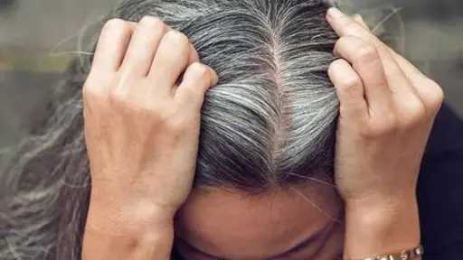 الشيب المبكر.. أزمة جمالية لها حلول.. اكتشف الأسباب وطرق الوقاية الطبيعية