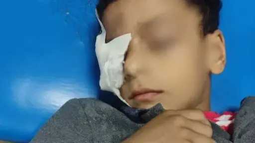 اتهام معلمة بالتسبب في فقدان تلميذ إحدى عينيه داخل مدرسة ابتدائية بنجع حمادي