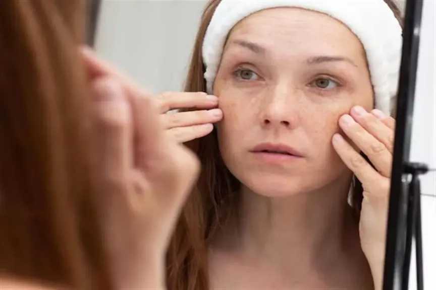 اكتشفي علامات نقص فيتامين د على بشرتك وشعرك عند النظر في المرآة