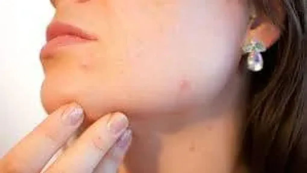 ترطيب البشرة