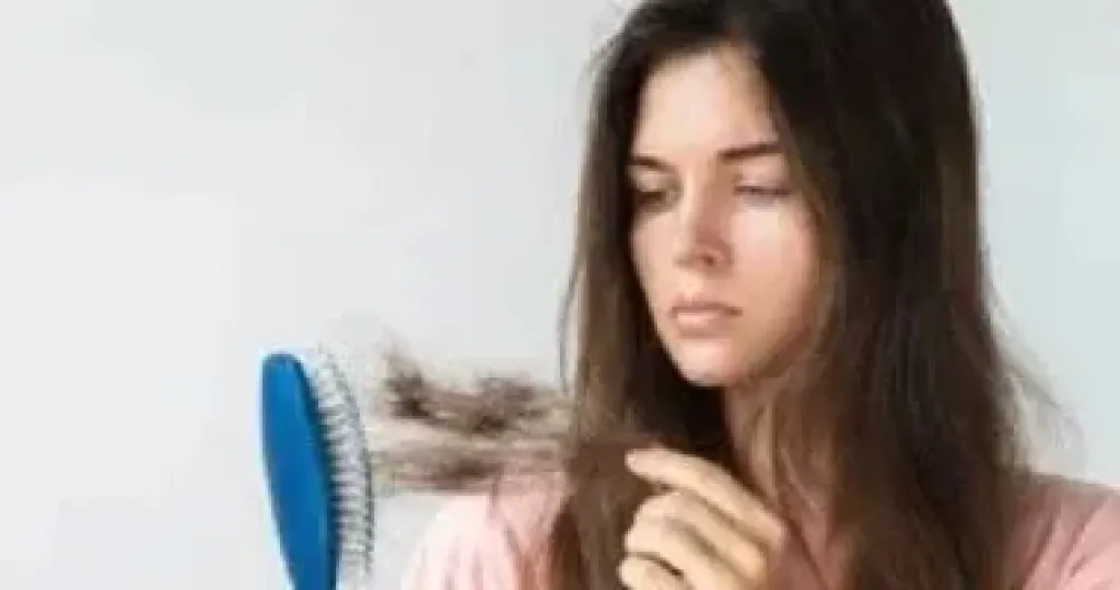 تساقط الشعر