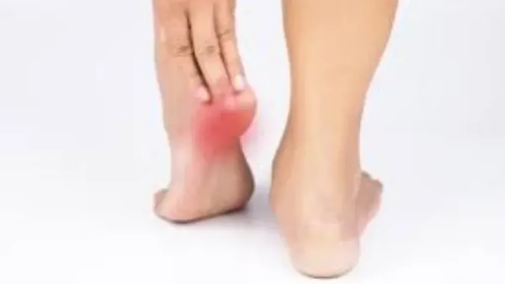 الشوكة العظمية