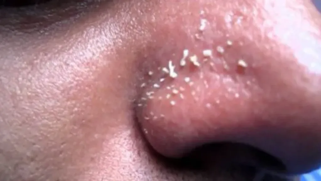 الرؤوس البيضاء