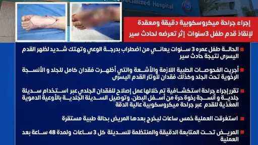 إنجاز طبي ينقذ قدم طفل.. جراحة ميكروسكوبية دقيقة في مستشفى الشيخ زايد... إنجاز طبي ينقذ قدم طفل.. جراحة ميكروسكوبية دقيقة في مستشفى الشيخ زايد التخصصي