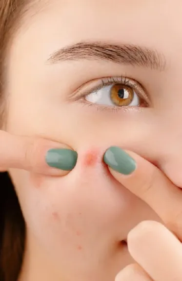 المسام الواسعة