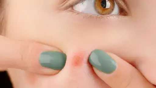 5 عادات خاطئة تؤدي إلى ظهور المسام الواسعة وكيفية تجنبها للحصول على بشرة مثالية