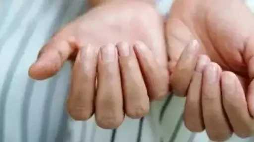 هشاشة الأظافر.. أسباب خفية وحلول عملية لتعزيز صحتها وجمالها