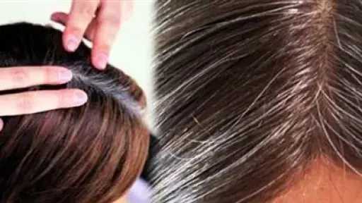 طرق فعّالة للوقاية من ظهور الشعر الأبيض.. نصائح شاملة للشباب والمراهقين طرق فعّالة للوقاية من ظهور الشعر الأبيض.. نصائح شاملة للشباب والمراهقين