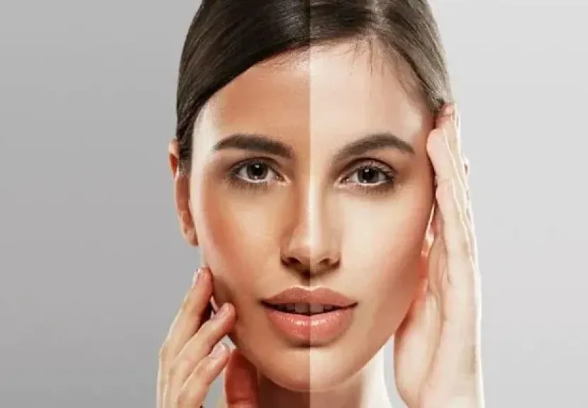 مناطق داكنة في الوجه