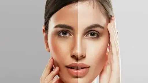 خلطات طبيعية فعّالة لتفتيح لون البشرة والتخلص من البقع الداكنة