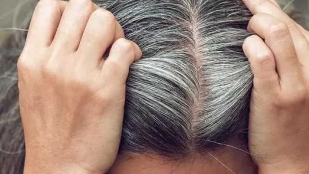 الشيب المبكر عند النساء.. الأسباب وكيفية الوقاية منه